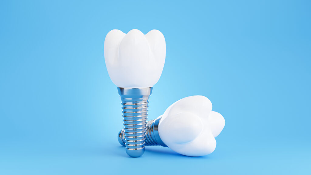 dental implants near me fletcher north carolina