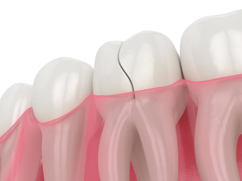 Emergency Dentist Near Me emergency dentist near me fletcher north carolina