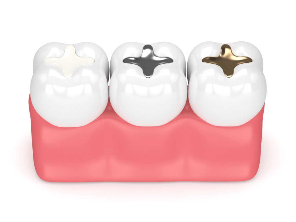 tooth filling fletcher nc