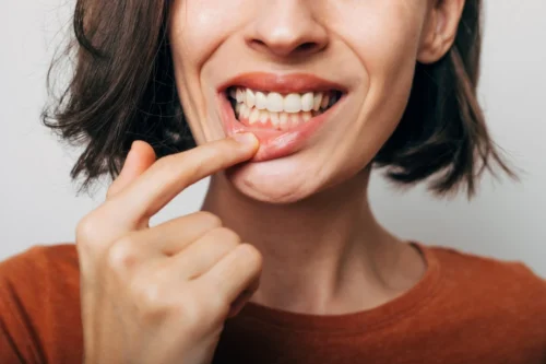 The Most Common Causes of Bleeding Gums and How You Prevent Them The Most Common Causes of Bleeding Gums and How You Prevent Them