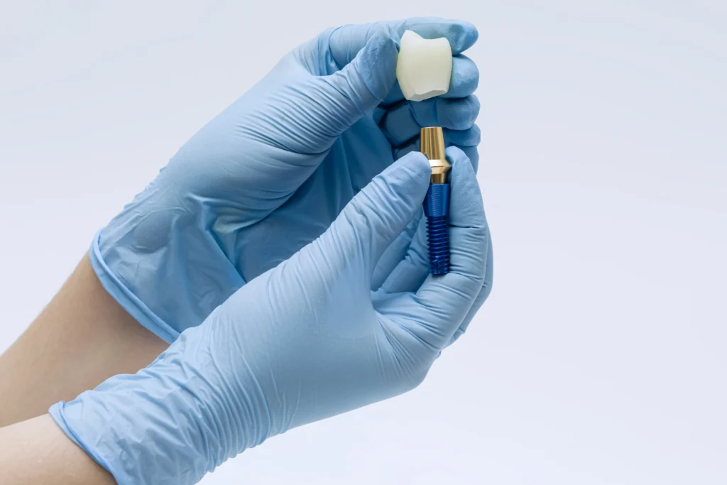 Replacing Missing Teeth: Are Dental Implants or Dentures Right for You? Missing Teeth - Fletcher, NC